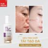 Tinh Chất Trẻ Hoá, Tái Tạo Da SURMEDIC Super Peptide 100tm Collagen Lifting Serum 50ml