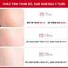 Siêu Tinh Chất Tranexamic Acid Xoá Thâm Đỏ, Mờ Sạm Nám Angel Liquid Tranexamic Mela Ampoule 30ml