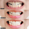 Kem Đánh Răng Median Dental IQ 93%