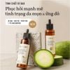 Tinh Chất Bí Đao Sáng Da Và Giảm Mụn COCOON 70ml