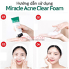 Sữa rửa mặt Some By Mi AHA-BHA-PHA 30 Days Miracle Acne Clear Foam