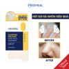 Mặt Nạ Ngủ Cho Mũi Mediheal Sleeping Melting Nose Pack (Hộp 3 Miếng)