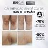 Sữa dưỡng thể MD Care B.R.I.G.H.T Brightening Booster Body Lotion 200ml