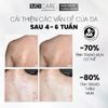 Xịt tẩy tế bào chết toàn thân MD Care E.X.F.O Exfoliating Body Spray 100ml