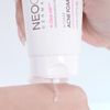 Sữa rửa mặt Neogen Dermalogy A-Clear Acne Foam Cleanser 150ml