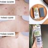 Xịt Giảm Mụn Lưng Pelican For Back Medicated Body Lotion 100ml