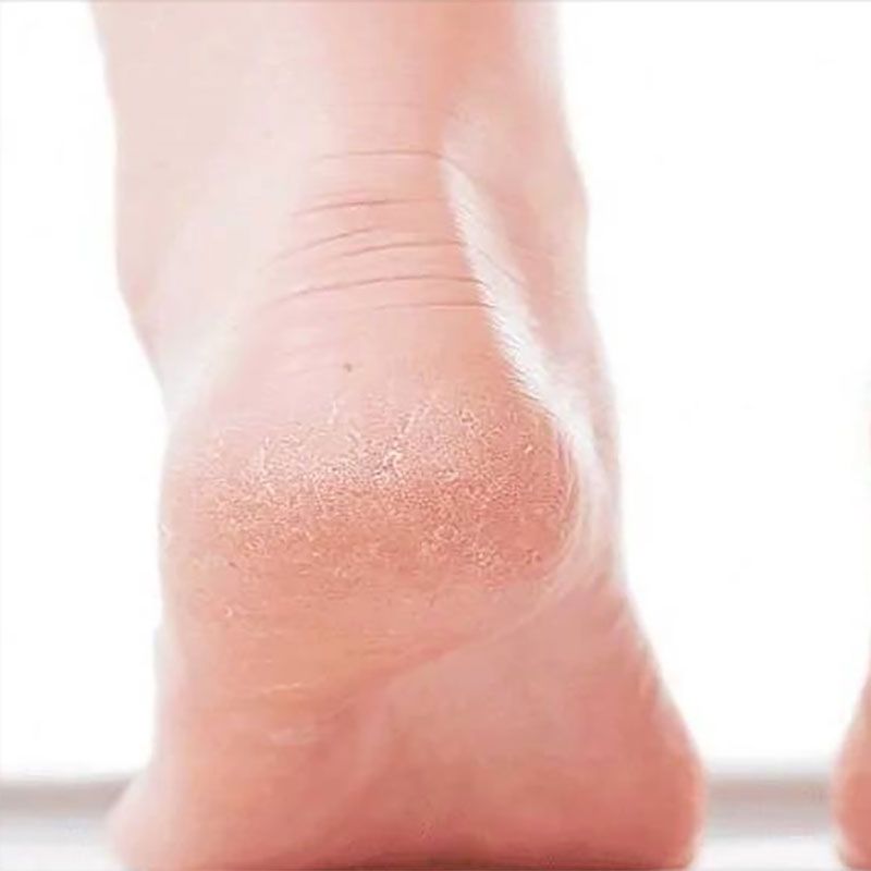  Kem dưỡng ngừa khô nứt da chân, gót chân Manuka Doctor Peppermint Foot & Heel Cream 75ml (UK - Anh Quốc) 