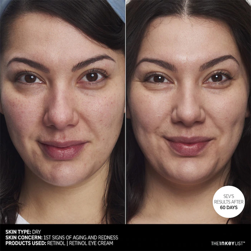 The Inkey List Retinol Arrugas