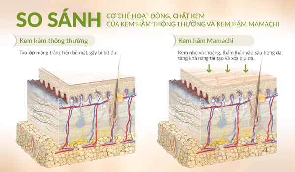  Kem ngăn ngừa và điều trị hăm Mamachi 50gr 