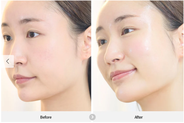  REJURAN - serum 5 tác động kim cương. Dual Effect Ampoule c-PDRN 0.5% (30ml) 