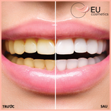 Kem đánh răng Dontodent hàng nội địa Đức cho răng sáng khoẻ - Tuýp 125ml