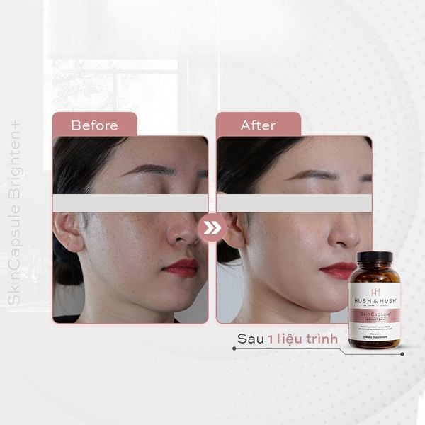 Viên Uống trắng da mờ nám Hush & Hush Skin Capsule Brighten+ 60 Viên