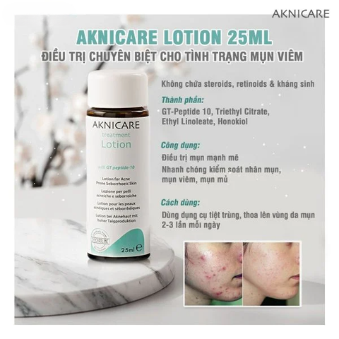 Lotion làm sạch trị mụn cho da dầu mụn | Ngừa thâm mụn Aknicare Lotion 25ml