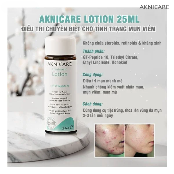  Lotion Kiểm Soát Cồi Mụn Aknicare Lotion 25ml 