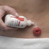 Bột hút ẩm chống loét hậu môn nhân tạo Hollister Adapt Stoma Power 7906