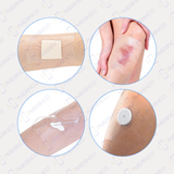 Băng vô trùng không gạc trong suốt không thấm nước Sterile Adflex (Non-Pad) 10cmx12cm