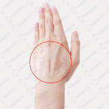 Băng vô trùng không gạc trong suốt không thấm nước Sterile Adflex (Non-Pad) 10cmx12cm