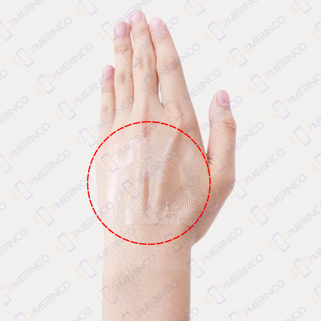 Băng vô trùng không gạc trong suốt không thấm nước Sterile Adflex (Non-Pad) 10cmx12cm