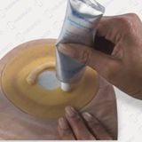 Keo làm đầy ConvaTec chống rò rỉ cho hậu môn nhân tạo