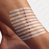 Miếng dán vết thương tránh giãn sẹo thay chỉ khâu 3M™ STERI-STRIP™ R1546 (6x100mm)