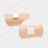 Gạc xốp siêu thấm hút không dính vào vết thương Therasorb Algi Plus Hydrophilic (1 miếng)