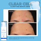  Kem kiểm soát mụn và điều tiết nhờn - CLEAR CELL Clarifying Repair Crème [IMAGE] 