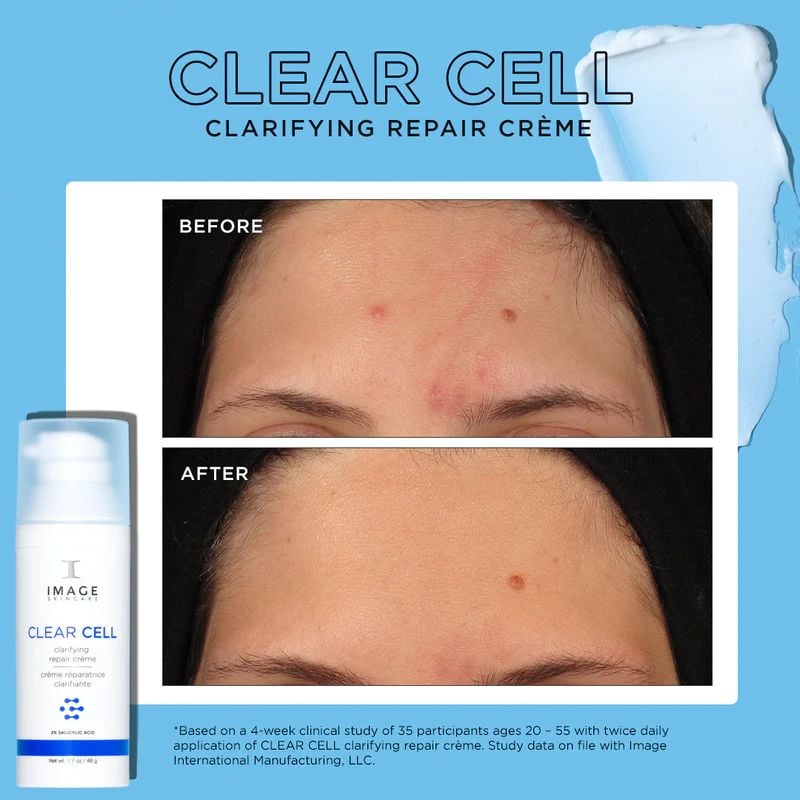  Kem kiểm soát mụn và điều tiết nhờn - CLEAR CELL Clarifying Repair Crème [IMAGE] 