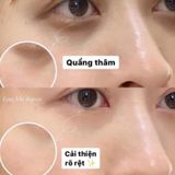  Kem chống lão hoá vùng mắt SK-II Stempower Eye Cream 