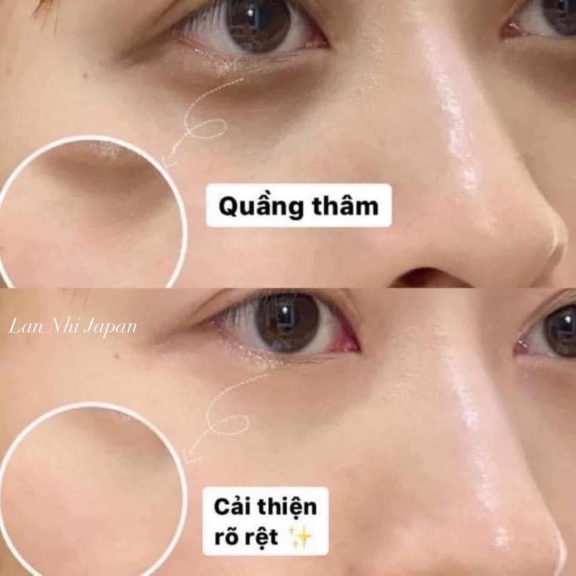  Kem chống lão hoá vùng mắt SK-II Stempower Eye Cream 