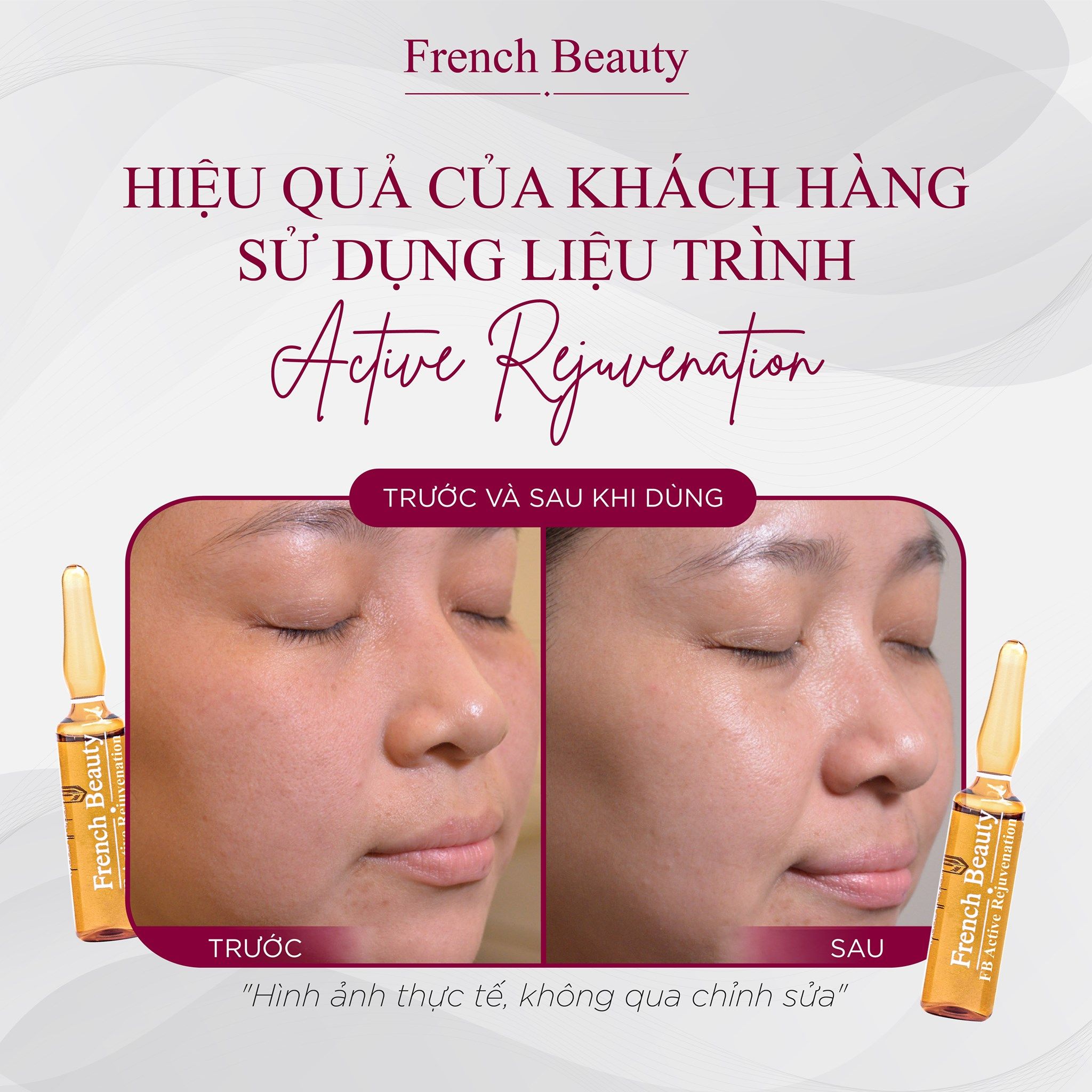  Tinh Chất Tế Bào Gốc Dưỡng Ẩm Tái Tạo Và Chống Lão Hóa - FB Active Rejuvenation 