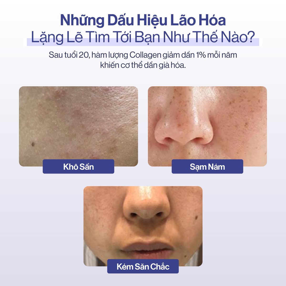  Combo 2 Nước Uống Collagen Gilaa Siêu Phân Tử 300DA (20g x 30 gói) 