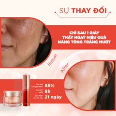 Combo Dưỡng Trắng 3D-Brighty LANCI (Serum + Kem Dưỡng Trắng) 50ml