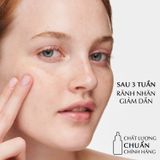  Tinh chất (Serum) phục hồi chống lão hóa ESTÉE LAUDER Advanced Night Repair Synchronized Multi-Recovery Complex 75ml 