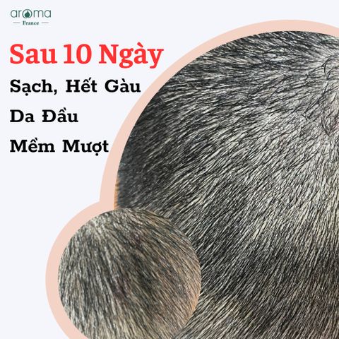 DẦU THIÊN NHIÊN TRỊ GÀU, NẤM DA ĐẦU, VẢY NẾN, CHÀM, NẤM MÓNG AN TOÀN TOONIC AROMA