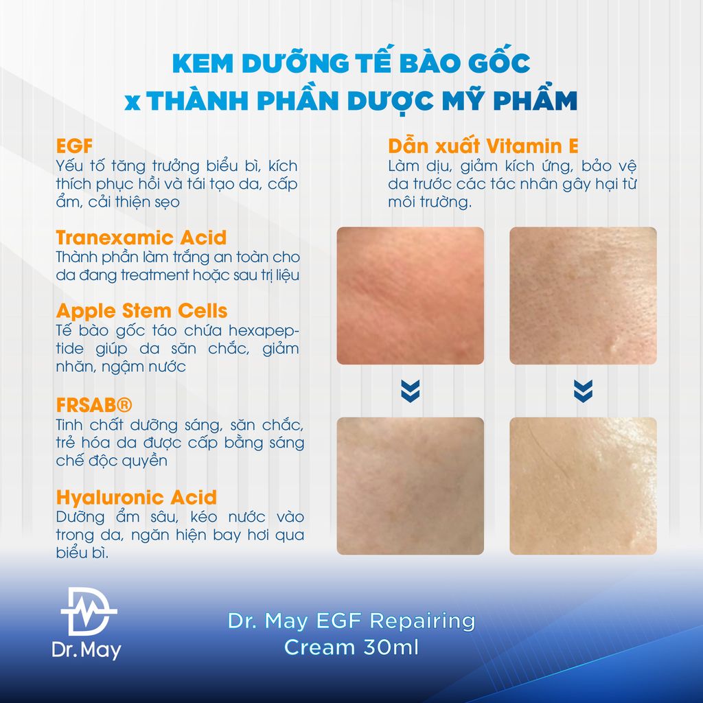 KEM DƯỠNG TẾ BÀO GỐC DR.MAY TÁI TẠO VÀ PHỤC HỒI DA TỔN THƯƠNG - DR.MAY EGF REPAIRING CREAM