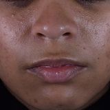  Serum Vitamin C Chống Oxy Hoá Da Dầu Silymarin CF Skinceuticals 