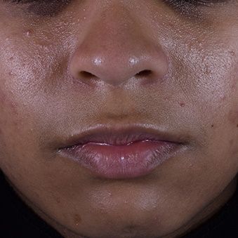  Serum Vitamin C Chống Oxy Hoá Da Dầu Silymarin CF Skinceuticals 