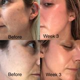  Serum Tái Tạo Growth Factor Serum ZO Skin Health 