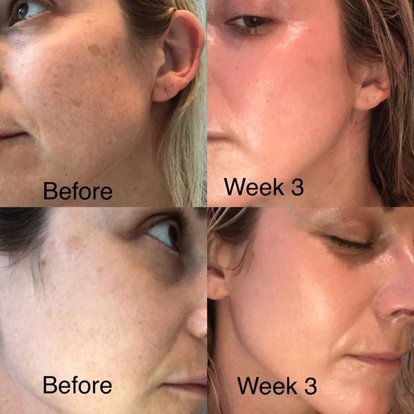  Serum Tái Tạo Growth Factor Serum ZO Skin Health 