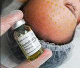  Peel Tái Tạo Da TCA BioRePeelCl3 