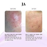  Serum Phục Hồi Chống Kích Ứng Folic Acid B9 Juliette Armand 