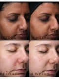  Serum Sáng Da Niacinamide 10% Medik8 Clarity Peptides 