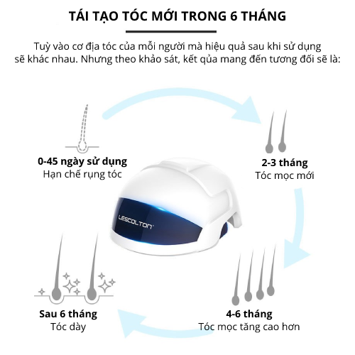 Nón laser hỗ trợ mọc tóc giảm dầu chân tóc - LESCOLTON
