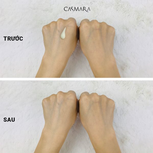 Kem chống nắng bảo vệ cực cao cho mặt Casmara
