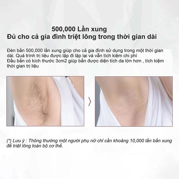 Máy triệt lông trẻ hoá da công nghệ IPL super Photon Nanotime B62F