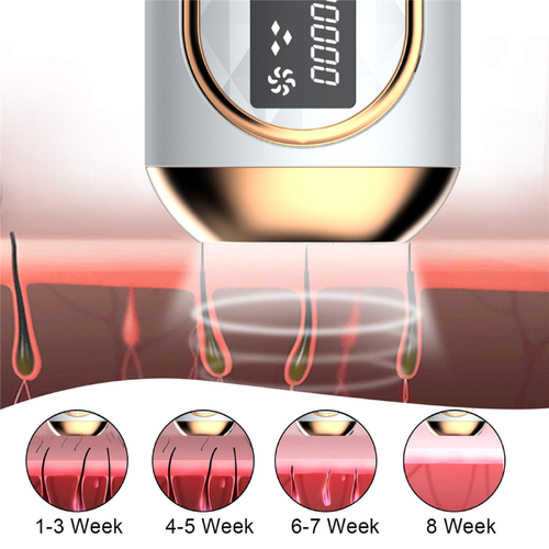 Máy triệt lông IPL Laser công nghệ Châu Âu bóng đèn thạch anh cao cấp - LUX HAIR