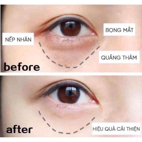  Kem mắt Estee 5 ml 