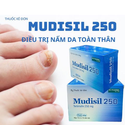 Thuốc Mudisil điều trị nấm da, tấm móng tay, nấm tóc (10 vỉ x 10 viên)