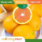  Cam Cara Mỹ 