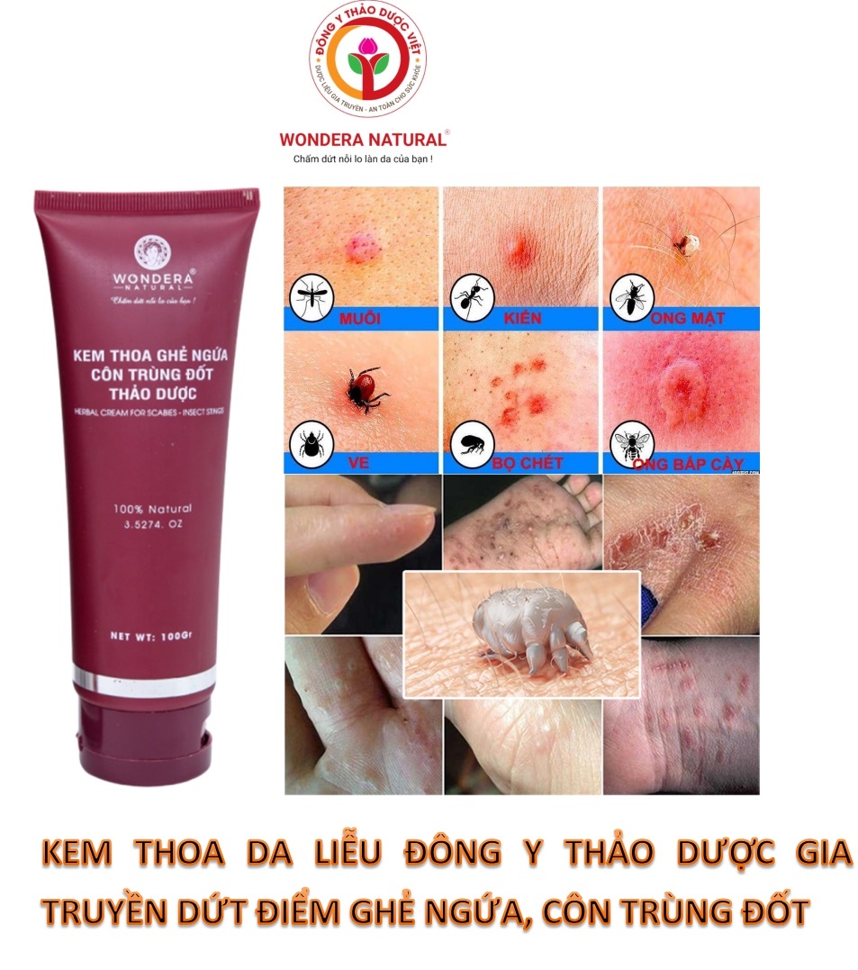 Kem thoa ghẻ ngứa côn trùng đốt thảo dược 100G